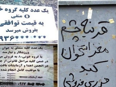 عراقی‌ها خریدار «کلیه» ایرانیان به قیمت دلار!