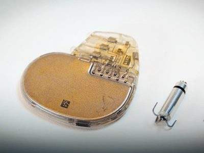 کوچک‌ترین ضربان‌ساز قلب جهان؛ تزریق‌پذیر، بی‌سیم و قابل‌جذب در بدن