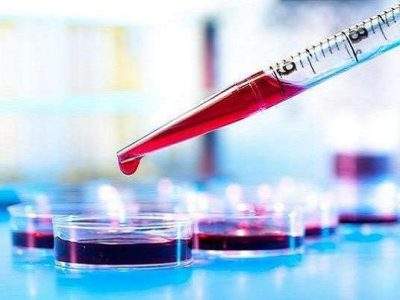 تشخیص آلزایمر تنها با یک آزمایش ساده