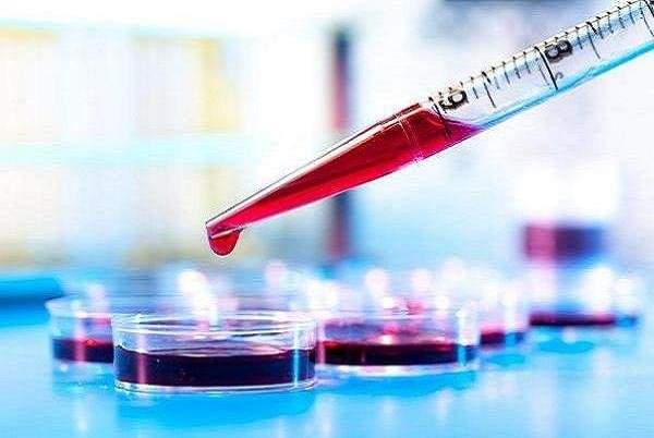 تشخیص آلزایمر تنها با یک آزمایش ساده