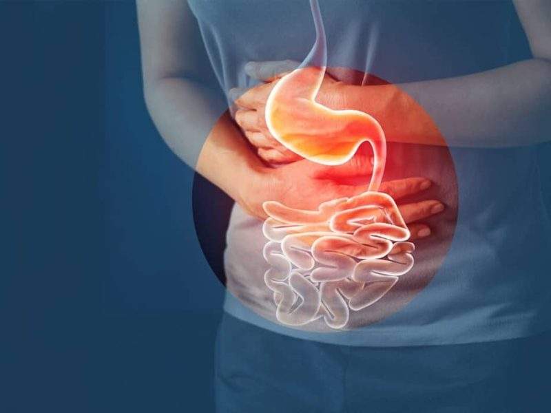 افزایش سرطان معده در استانهای شمالی