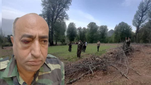 ضرب و جرح قرقبان گیلانی