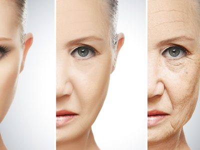 کلاژن خوراکی؛ سلاحی در برابر چین و چروک پوست