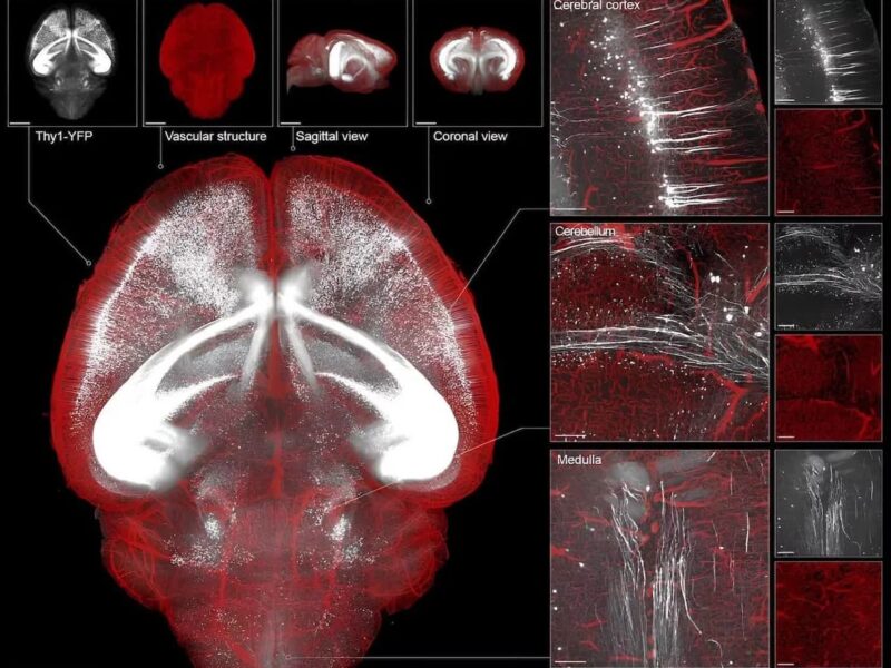 ابتکار محققان چینی برای مشاهده درون مغز