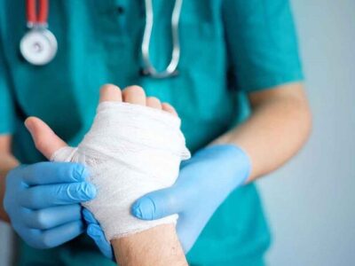 ۹۰ درصد سوختگی‌ها قابل پیشگیری است