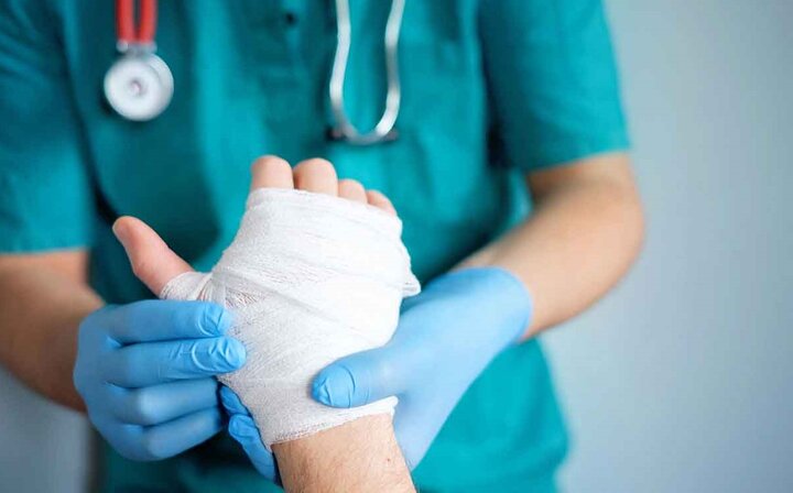 ۹۰ درصد سوختگیها قابل پیشگیری است