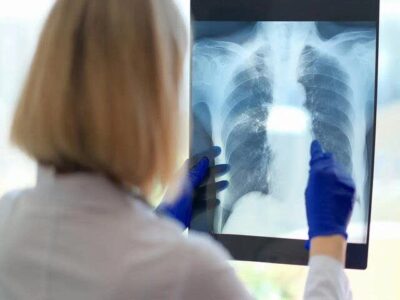 یک مشکل پنهان تنفسی ممکن است دلیل خستگی مزمن باشد